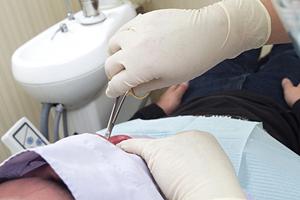 仙台で真剣に薄毛に悩んでいるのなら