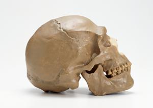 高知のあさひ皮膚科で光線過敏症の治療